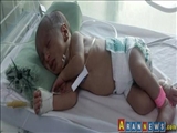 Yemenli çocuklar hastanede bile ölümle karşı karşıya
