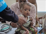 Yemen Sağlık Bakanı: Savaş Ve Abluka En Çok Çocukları Vuruyor